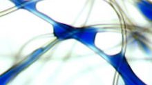 Vollprofile Schmelzklebefaser Full Profile Meltbonding Fiber